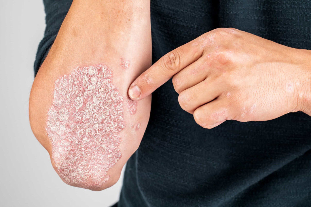 Skin Problems Recovery