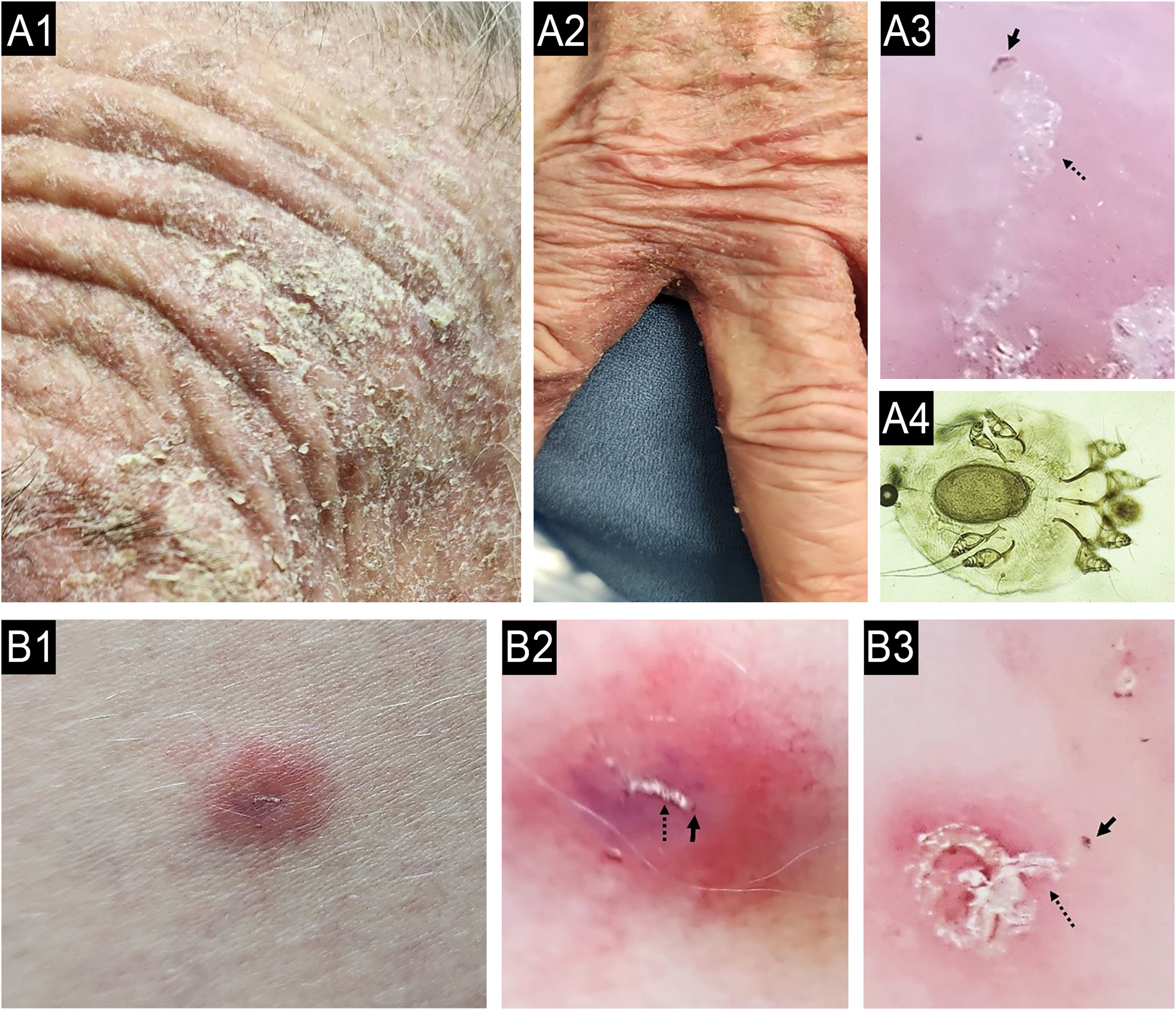 Chronic Itching Symptoms