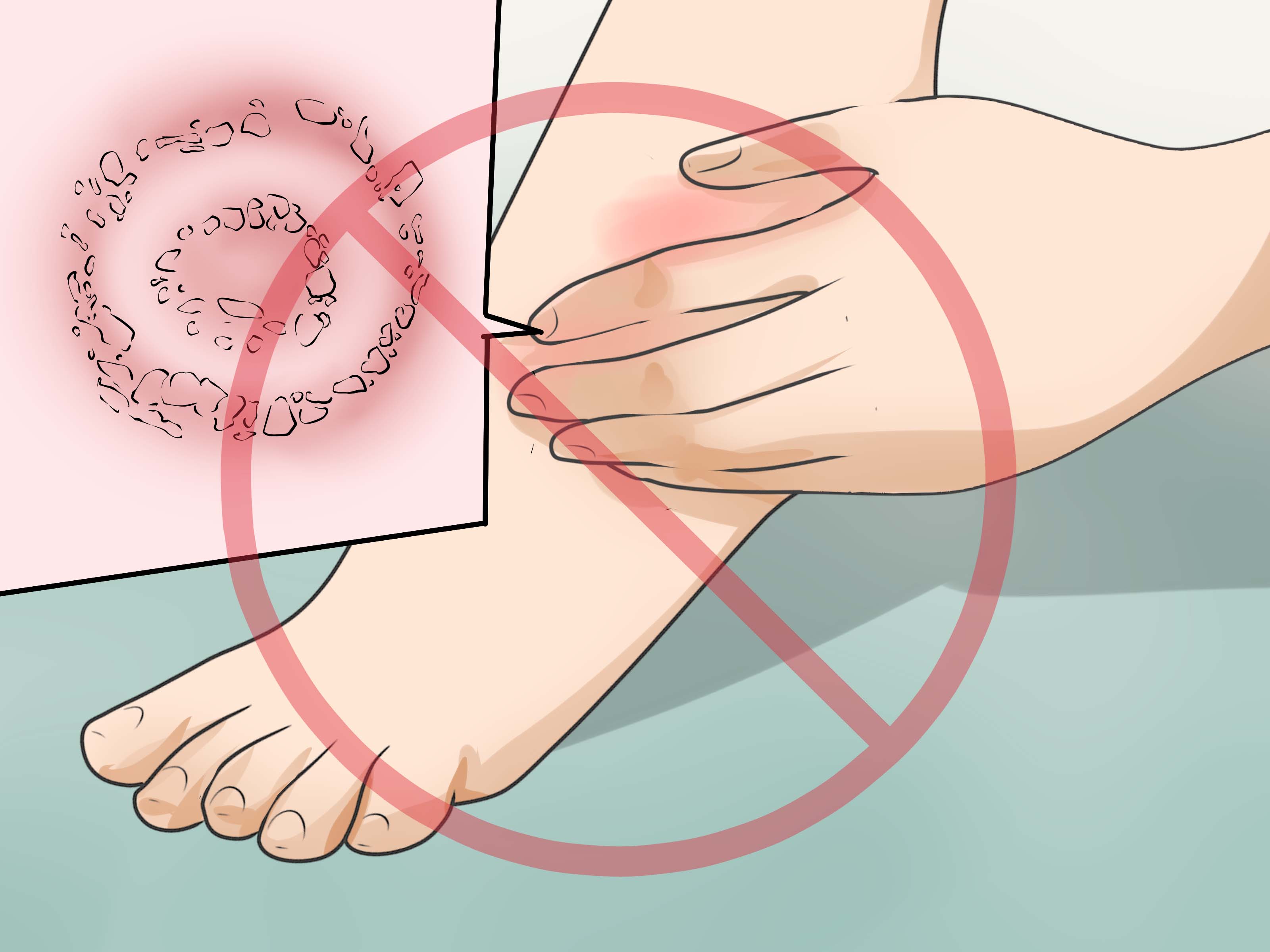 Prevention Tips